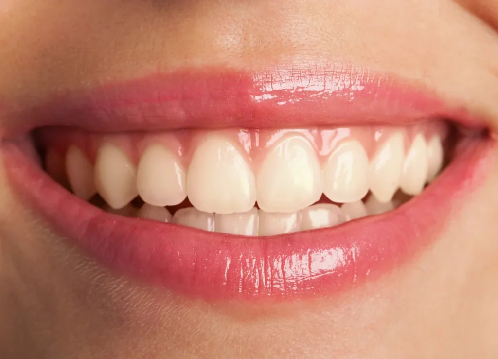 Teeth before treatment
